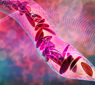 Hierro Protein-Succilinato: Prevención y Tx de la Anemia del embarazo y la lactancia