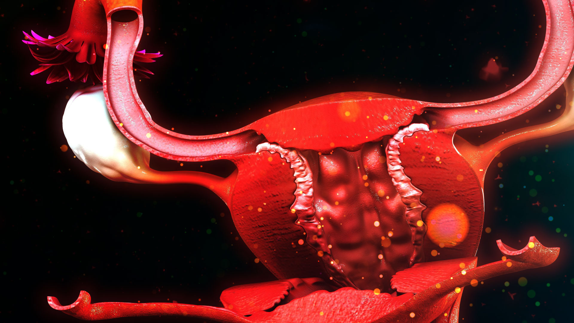 Reconstrucción cervical con conexión vaginal secundaria a agenesia cervical. Reporte de caso