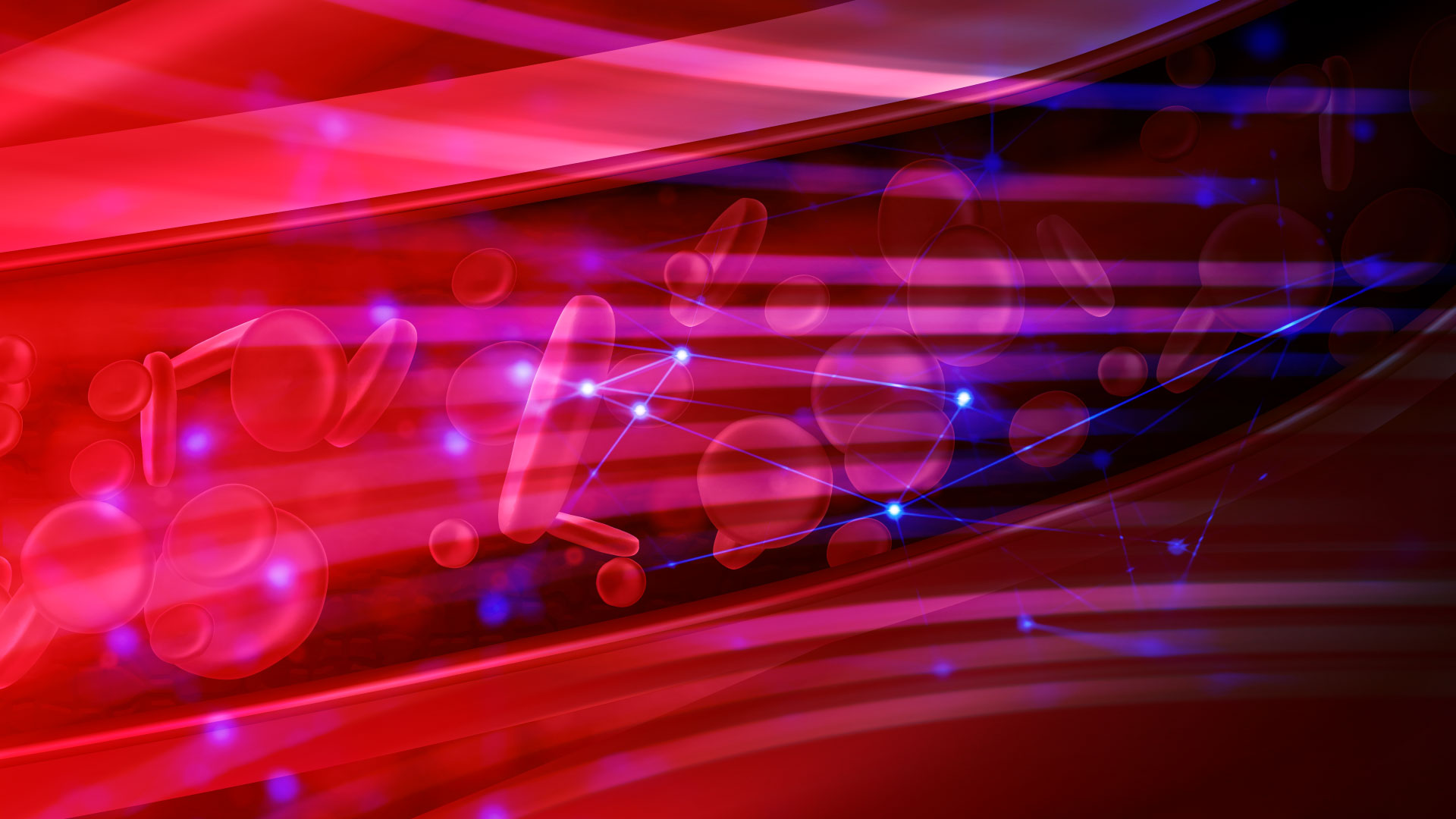 Ligadura de arterias hipogástricas modificada en inserción anómala de placenta, previa al alumbramiento o histerctomía obstétrica