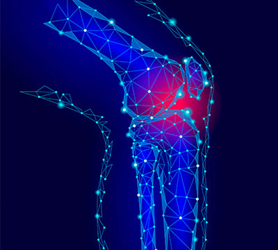 Osteoartritis: Prevención de los cambios degenerativos