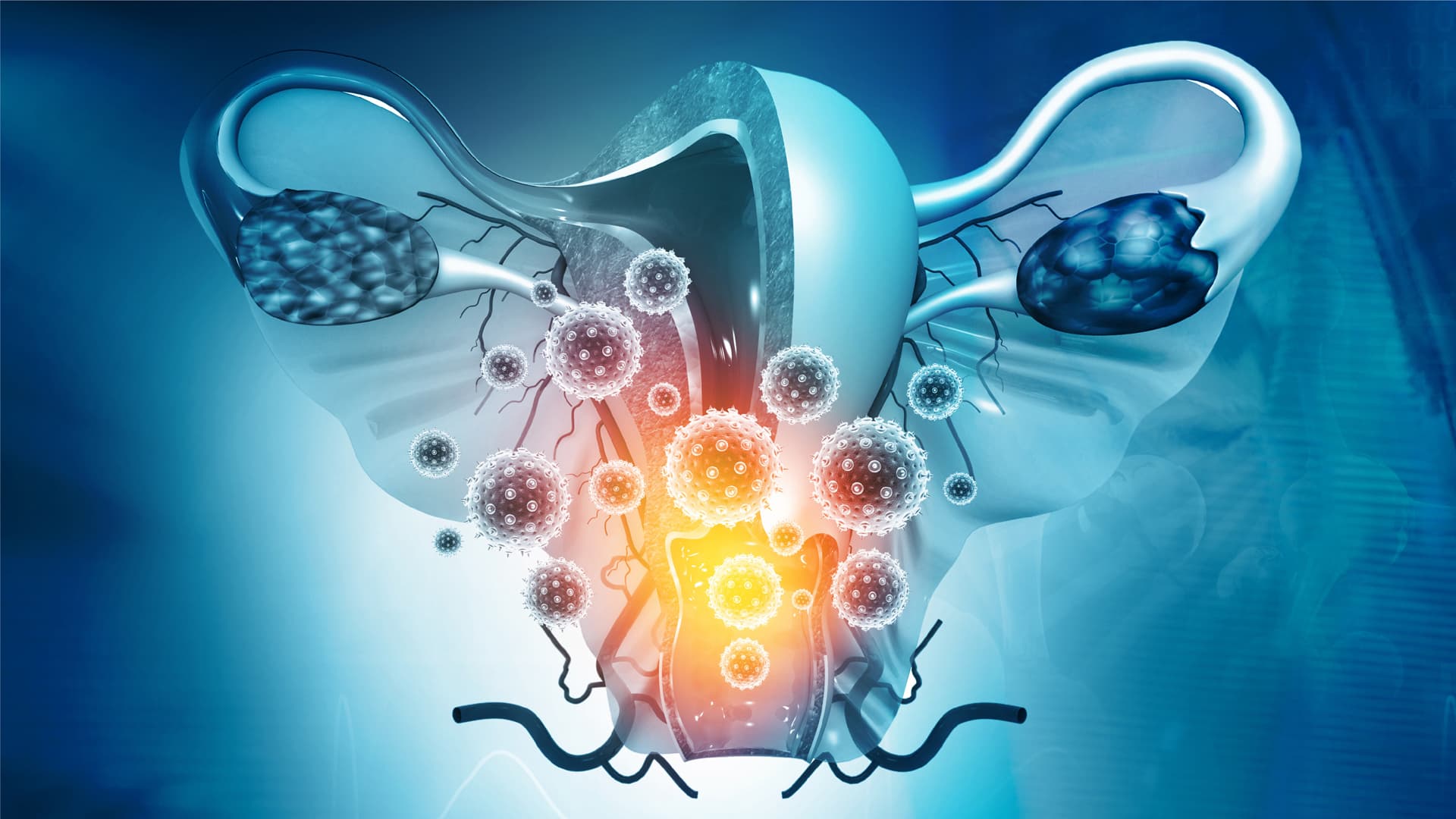 Gynophilus Restore,  Probioticos y su impacto en Infecciones Vaginales