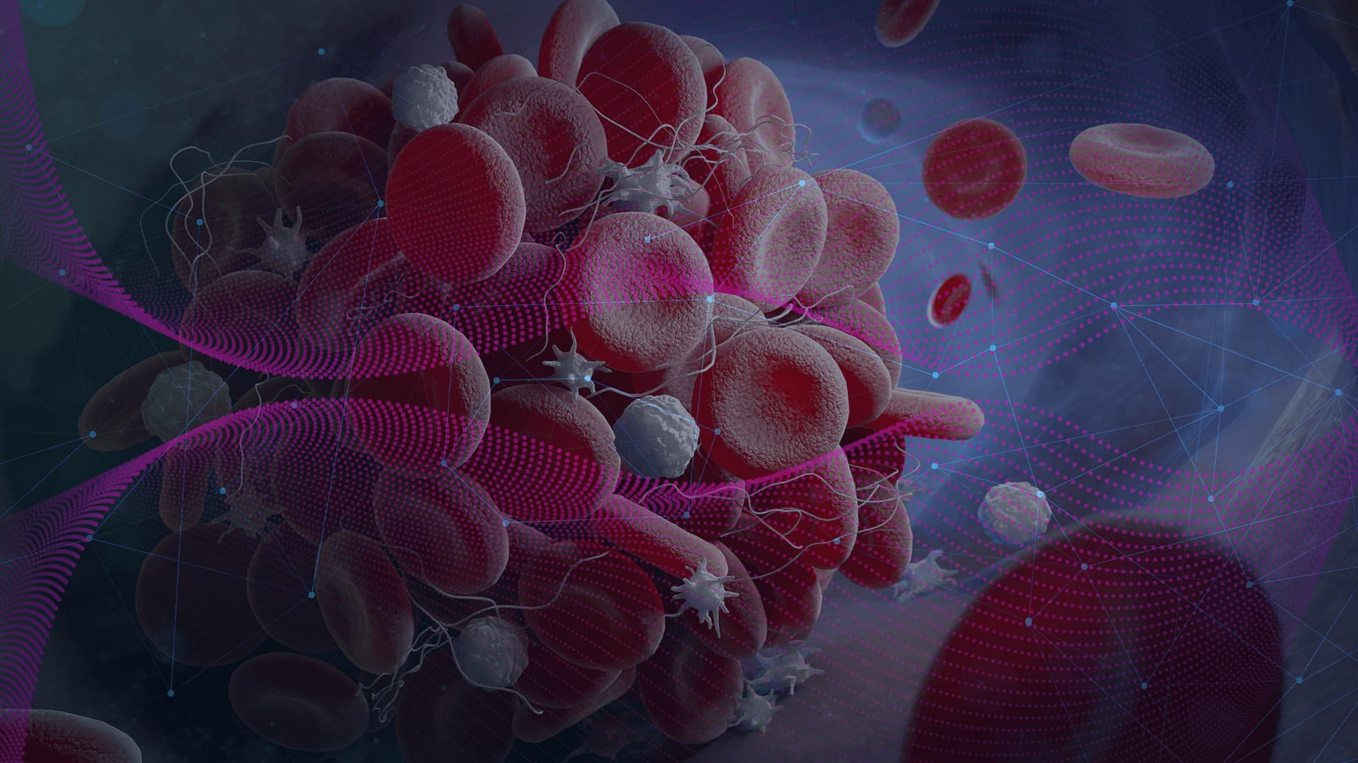 Riesgo Tromboembólico y Anticoncepción, la perspectiva GO