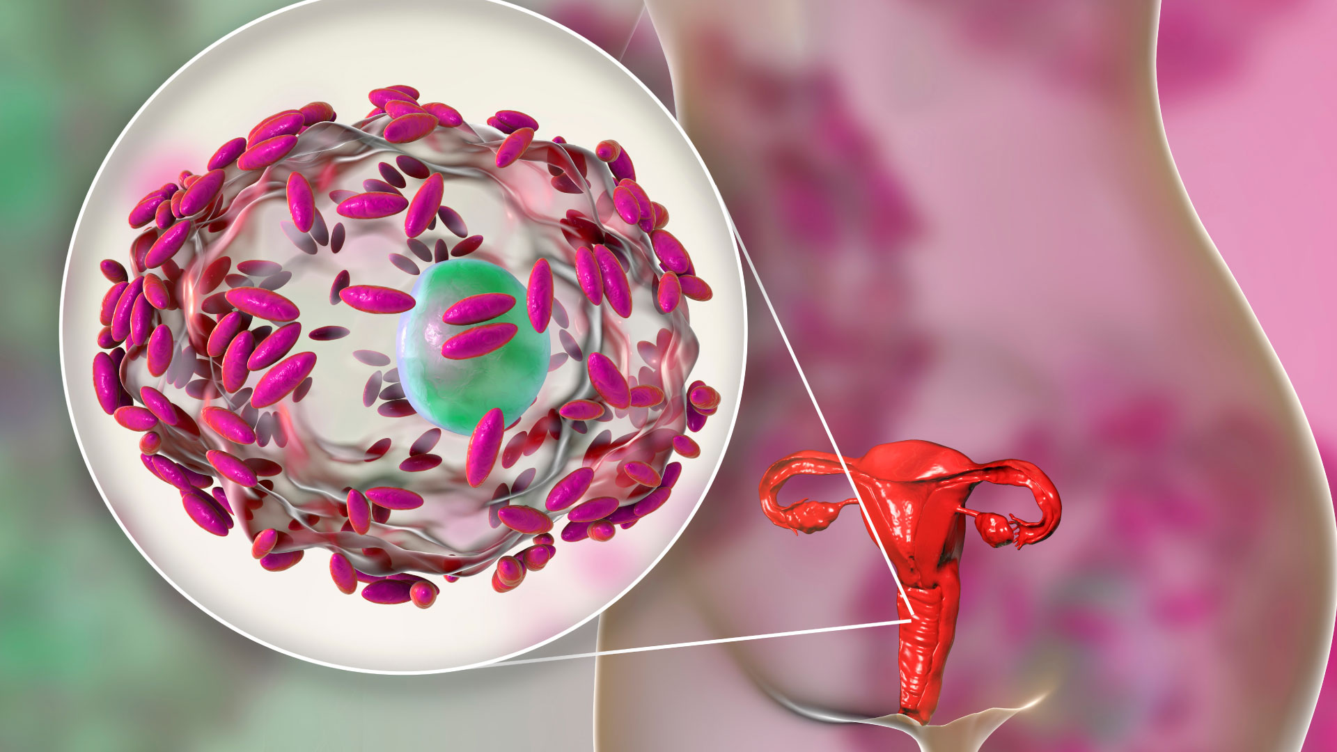 Microbiota mucho más allá de las infecciones vaginales