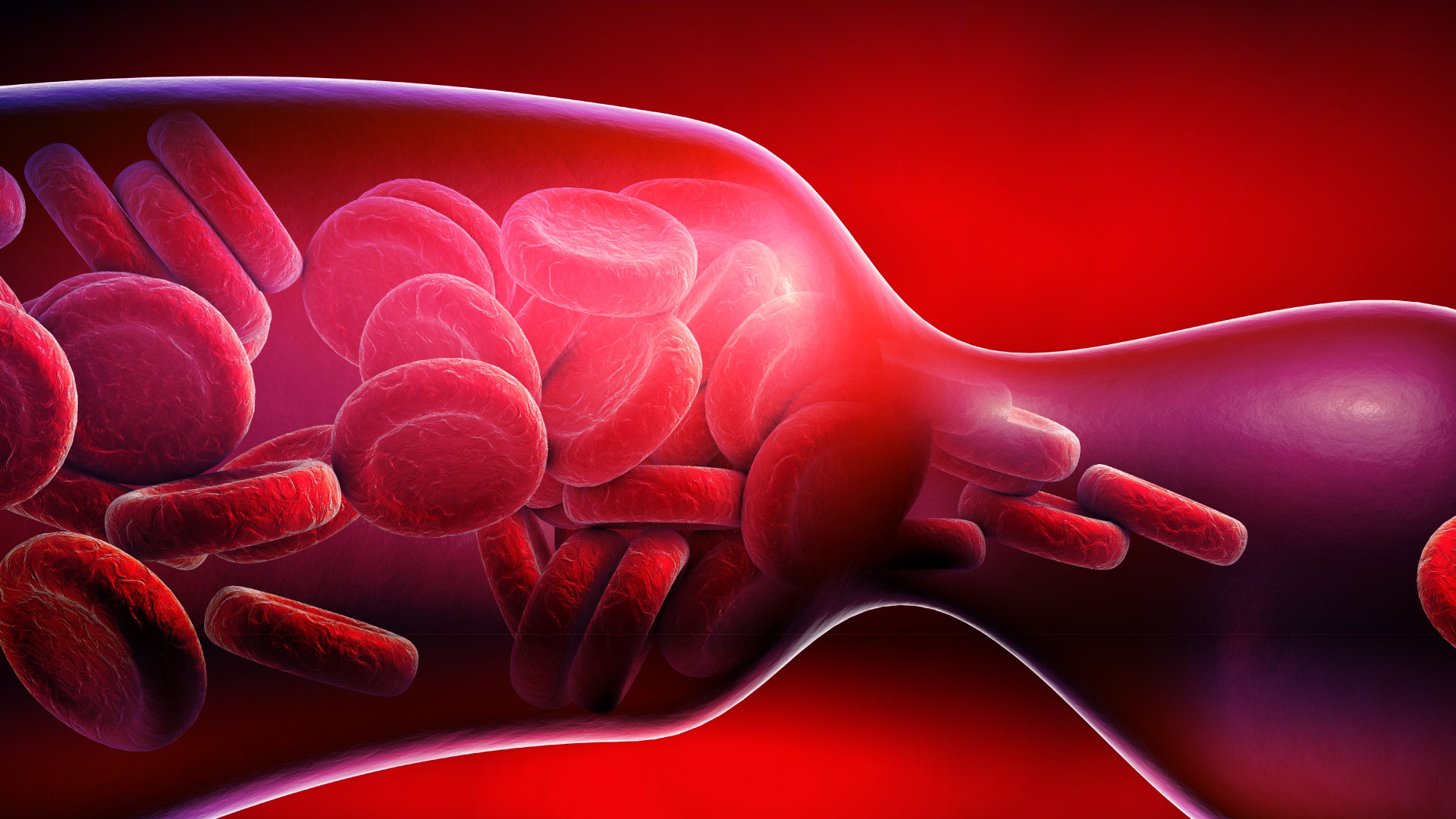 Riesgo tromboembólico venoso y anticonceptivos orales: a quien le llegan los pacientes con ETV